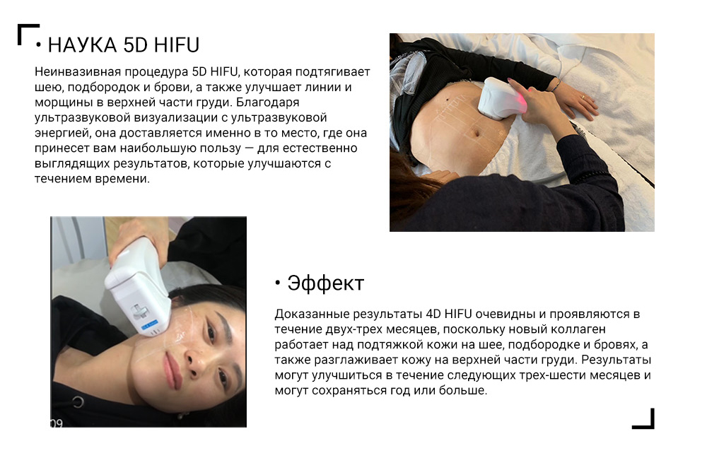 5D Hifu