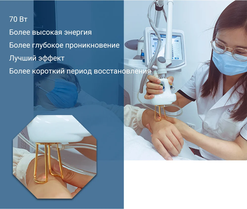 CO2-Laser-Resurfacing-3