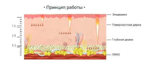 a8155007fb4d1c42f4478999c28db18
