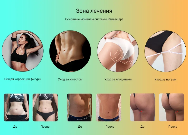 Части тела, применимые к EMS