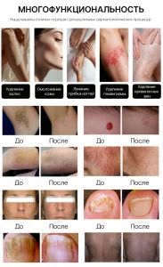 Многофункциональные александритовые лазерные устройства