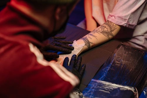 Пикосекундный лазер стойкий результат в лечении постакне и тату для вашего салона