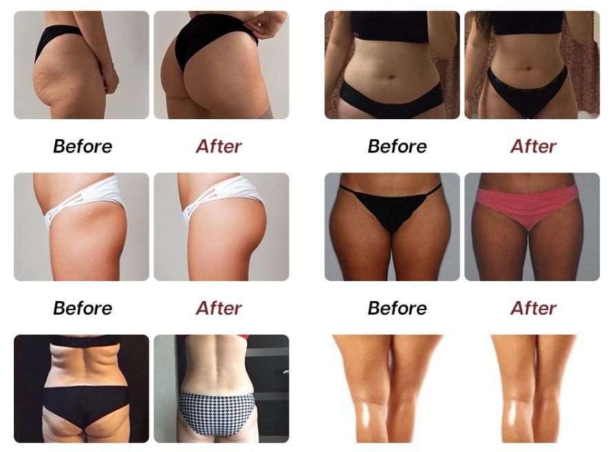 До и после результаты процедур с использованием оборудования