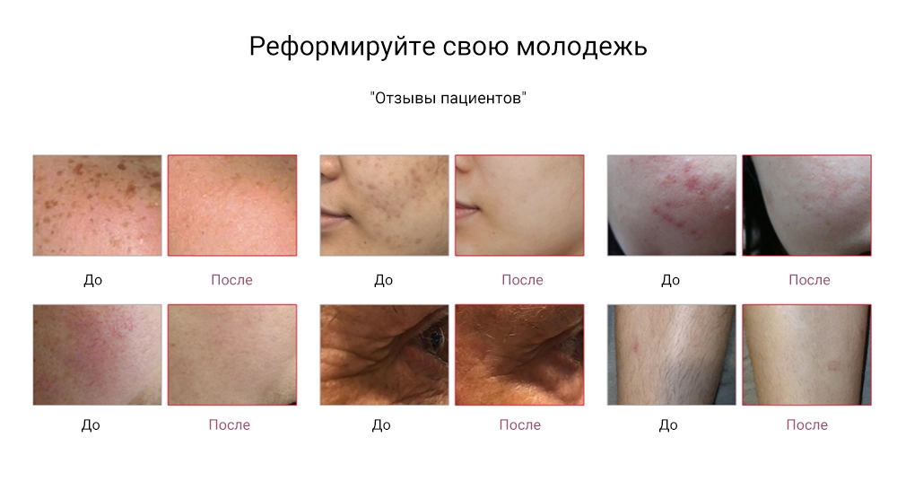 Многофункциональный косметический аппарат 5 в