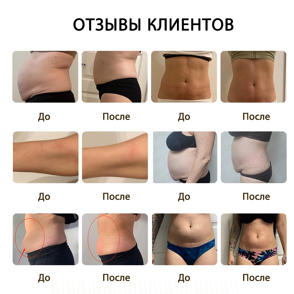 Отзывы клиентов результаты процедур по коррекции
