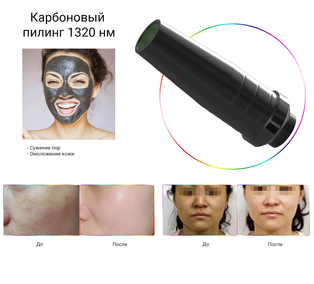 Пикосекундный лазерный аппарат для удаления пигментации