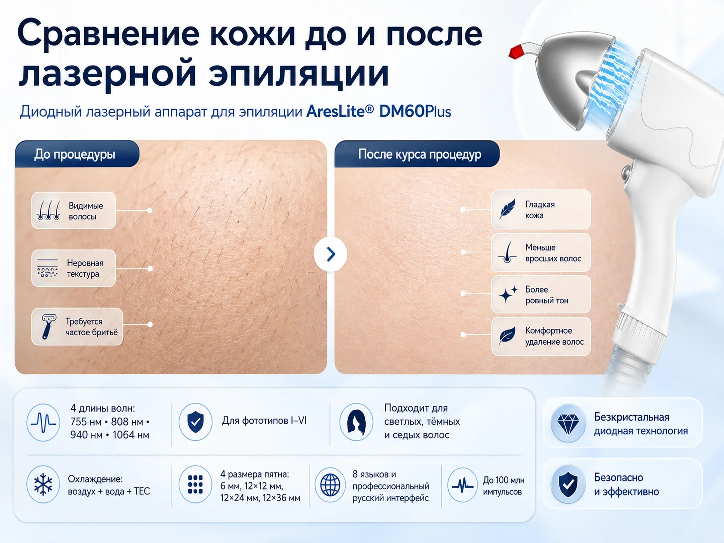 Cравнение кожи до и после лазерной эпиляции