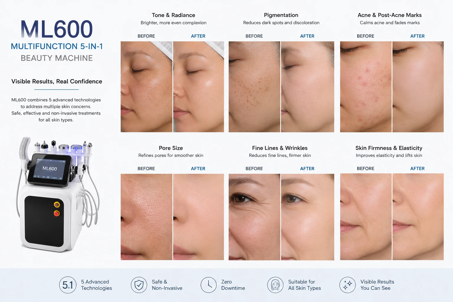 ML600_skin_effect_before_after_comparison