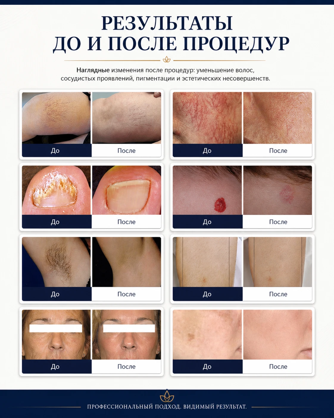 Результаты до и после процедур на аппарате ЭЛ200