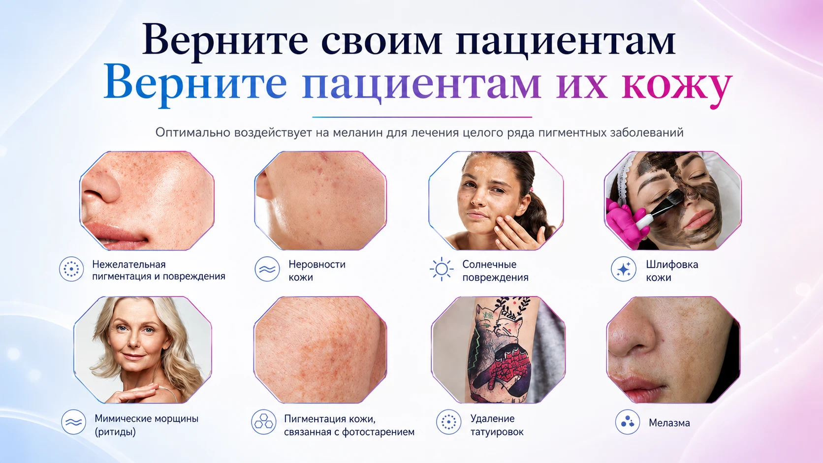 Коррекция пигментации и удаление татуировок