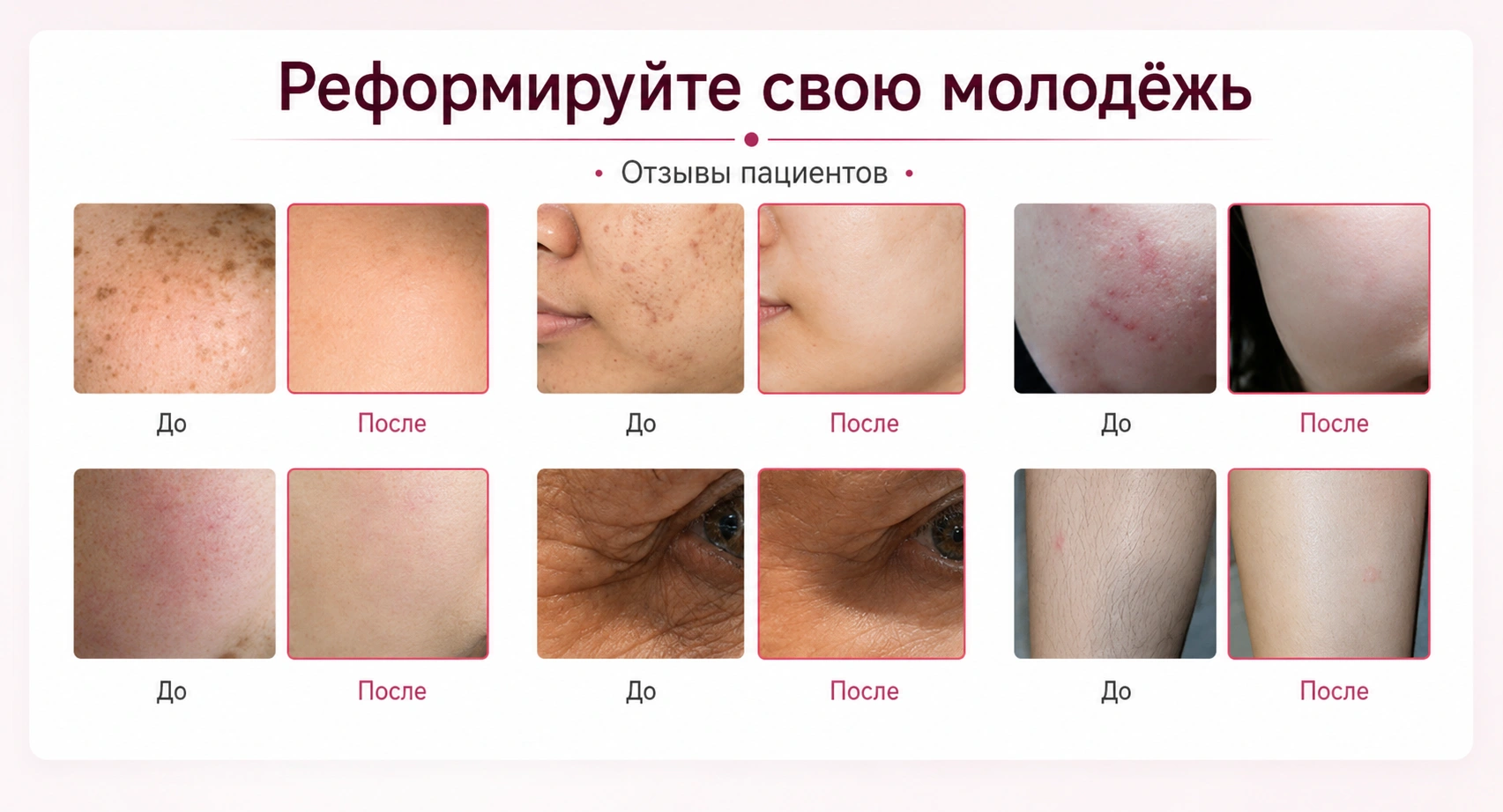 Результаты процедур до и после